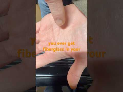How to get fiberglass out of your hand! #howto #lifehacks #tape #fiberglass