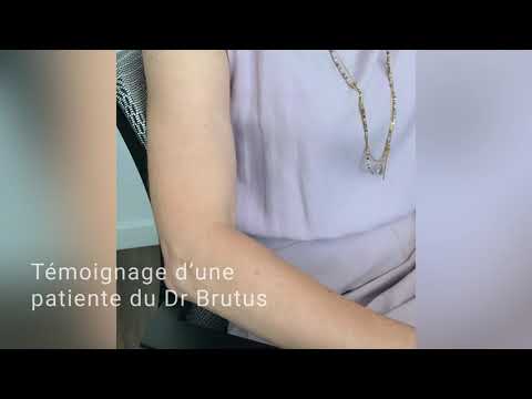 Témoignage d'une patiente du Dr Brutus | Épicondylite