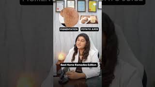 Best Home Remedies for Every Face Concern! ✨🍃