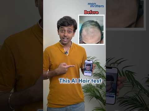 AI to solve hair loss? #ai #hairloss #alopecia #dermatologist #hairfall #balding #minoxidil