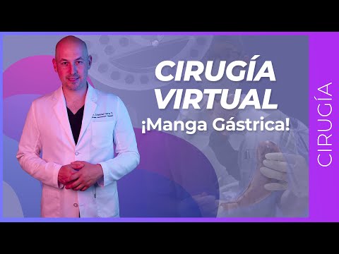 CIRUGÍA Virtual: MANGA GÁSTRICA