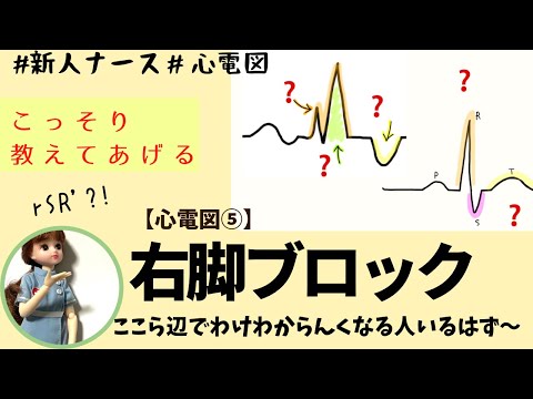 【心電図読み方⑤】右脚ブロックPVCと間違うなよん！！#看護師 #勉強#新人ナース
