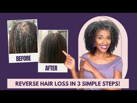 How to Reverse Hair Loss: 3 Proven Strategies