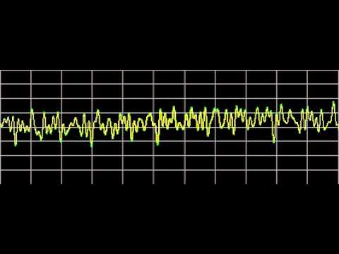 Cysts - Rife Frequencies