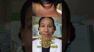Dark Neck?  Dermatologist Talks How to Fix Acanthosis Nigricans