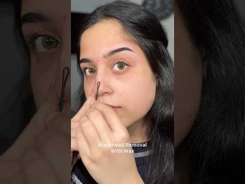 Instantly remove blackheads with hot wax. At home🌸