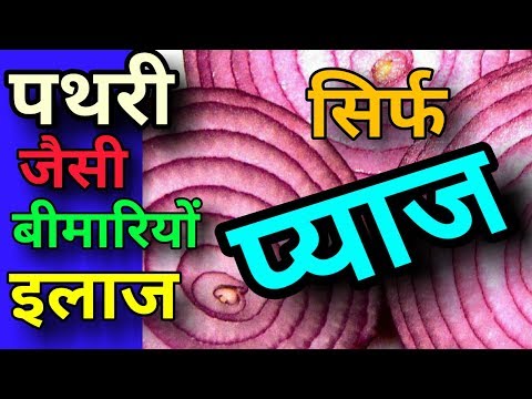 Benefits of onion/benefits of kandaa/health benefits of onion/health benefits of pyaz