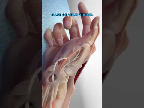 Basal Joint Surgery 3D Animation | #shorts #surgeryeducation