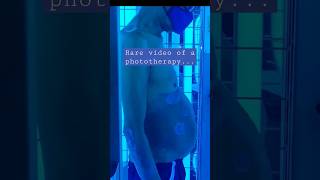 light cubicle |UVB phototherapy for psoriasis | #shorts