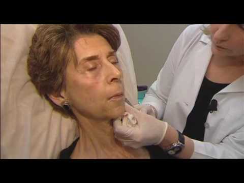 Replacing Lost Volume With JUVÉDERM VOLUMA® XC in Dallas