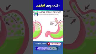 Pottalo #Gas Rakunda ? Chest Lo #Acidity Thggalante Ee Okkati Vadandi #DrManthenaSatyanarayanaRaju