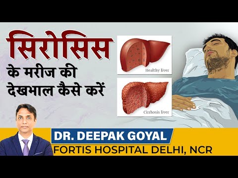 Liver Cirrhosis के मरीज़ की देखभाल कैसे करें