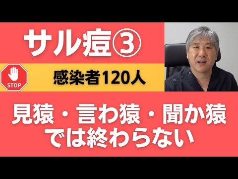 サル痘③、見猿・言わ猿・聞か猿ではおわらない。4/25、国内の感染者は120人に