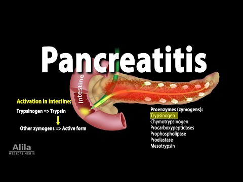 Pancreatitis, Acute and Chronic, Animation