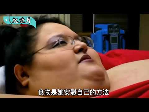 美国女人体重700斤，内脏支离破碎，为了活命做胃切除，纪录片