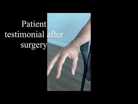 How to perform a thumb replacement surgery with a Maia Implant under Walant