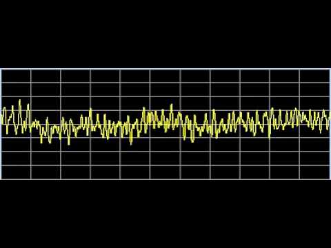 Scar Tissue - Rife Frequencies