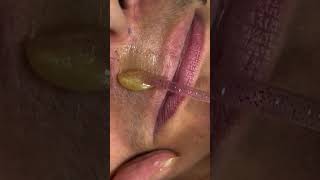 Upper lips waxing tutorial tips trucks #wax #ricawax #newartist