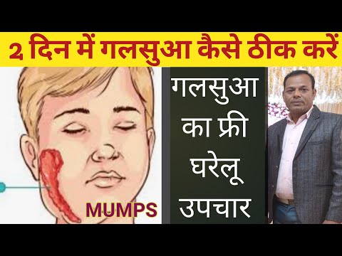 2 दिन में गलसुआ कैसे ठीक करें l galsua ka gharelu upchar l Mumps treatment