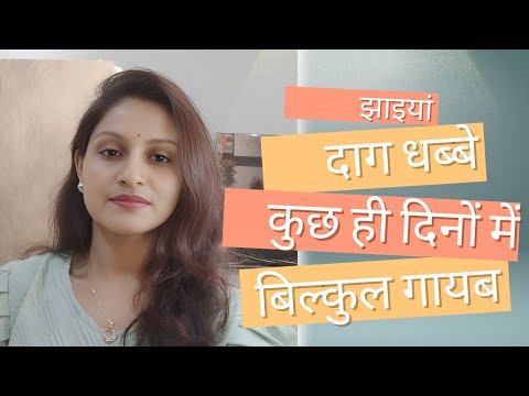 दाग धब्बे और झाइयां 20 दिनों में गायब ! Reduce pigmentation & melasma
