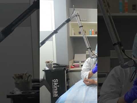 Best Laser Tattoo Removal in Rajasthan at Skinaa Clinic #viralvideo