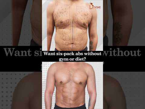 6 Pack Abs | 4D Body Contouring: Get a Sculpted Physique Instantly!