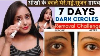 How to Remove Under Eye Dark Circles / Puffy Eyes & Eye Bags with 7Days Natural Under Eye Cream.