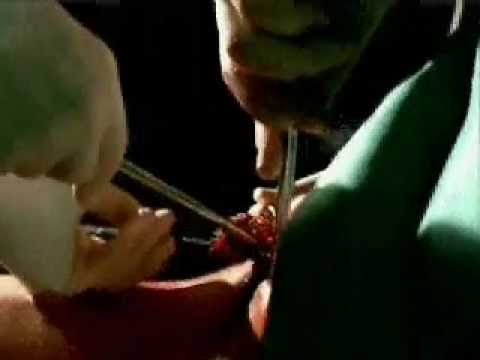 Timebomb SunSmart Campaign (2002) - Prevention & Early Detection of Skin Cancer