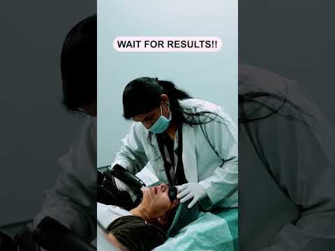 Get Rid of Unwanted Hair with Laser Hair Removal at Skinaa Clinic! #Viral #shortsvideo