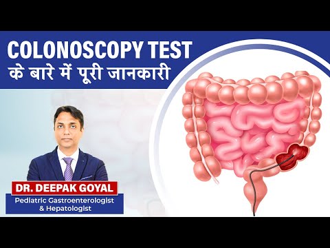 COLONOSCOPY TEST | DONT BE SCARED