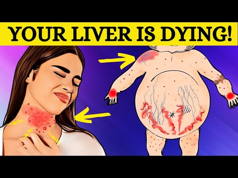 SILENT THREAT! These 8 Signs Could Indicate Fatty Liver Disease!