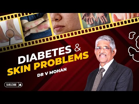 Diabetes and Skin Problems | Dr V Mohan