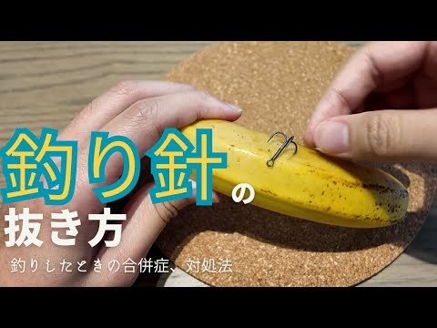 【マイナーエマージェンシー】釣り針除去！糸を使ったstring法で釣りの事故も怖くない！