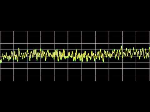 Rheumatoid Arthritis - Rife Frequencies