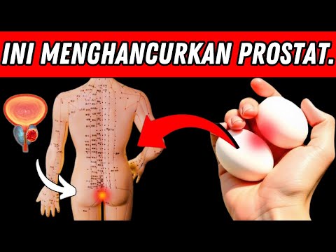 5 Makanan yang Harus Dihindari untuk Kesehatan Prostat 🍖❌🍷🚫 | Jaga Kesehatan Pria 👨‍⚕️💪