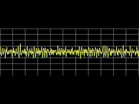 Glandular Balance - Rife Frequencies