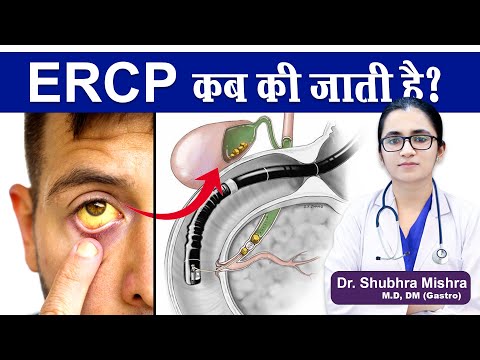 ERCP कब की जाती है ? || ERCP