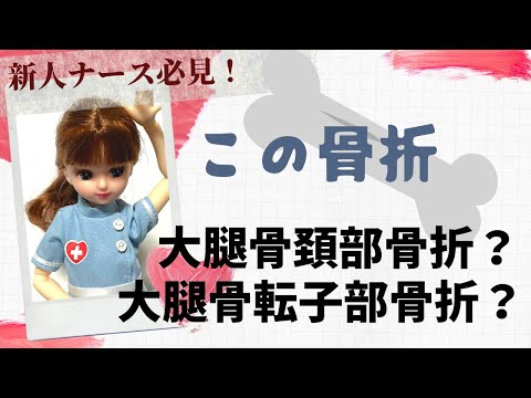 【勉強】大腿骨頚部骨折？転子部骨折？違い本当にわかってる？！#看護師 #整形外科#新人ナース
