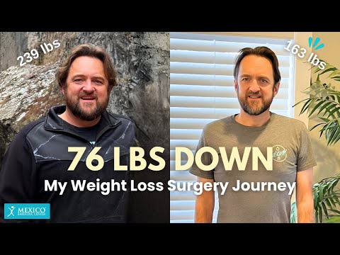 I LOST 76 POUNDS! | Sharing my Weight Loss Journey with Duodenal Switch (SADI-S)