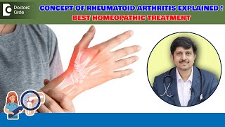 Rheumatoid Arthritis RA Factor controlled by Homeopathy- Dr. Sanjay Panicker | Doctors' Circle