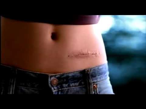 SunSmart Campaign: Skin cancer - it's killer body art