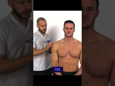 The Arm Squeeze Test for Cervical Nerve Root Compression