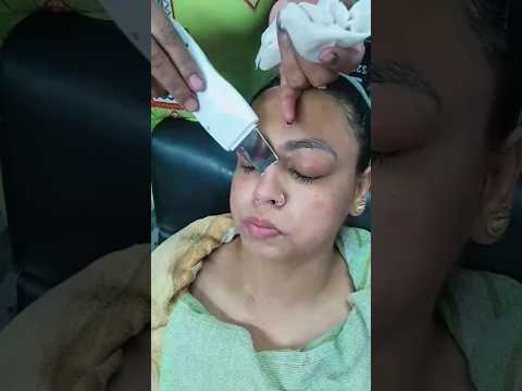 Using Ultrasonic blackheads remover ❤️#ytshorts #professional #ultrasonic #facial #blackheads #reel
