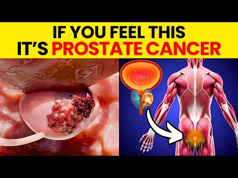 Prostate Cancer: 10 Early Signs and Symptoms. Don’t Ignore!