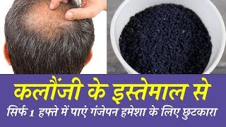 कलौंजी के इस इस्तेमाल से सिर्फ 1 हफ्ते में पाएं गंजेपन हमेशा के लिए छुटकारा