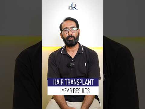 Dr Rana Irfan Patient Review !#DrRanaIrfan #HairRestoration #hairtransplant #fyp #shorts