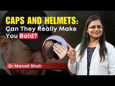 क्या Caps और Helmets से Hair Loss होता है? | Helmet & Cap Hair Loss: Fact or Fiction? | HairMD, Pune