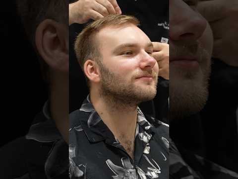 Cosmedica Clinic Hair Transplant in Turkey #shorts #hairtransplant #video