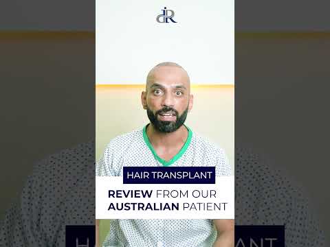 Hair Transplant Patient Review  #drranairfan #hairfall #hairlosssolution #baldness #hairtransplant