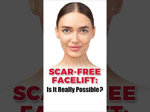 Scar-Free Facelift: Is It Really Possible? #ytshorts